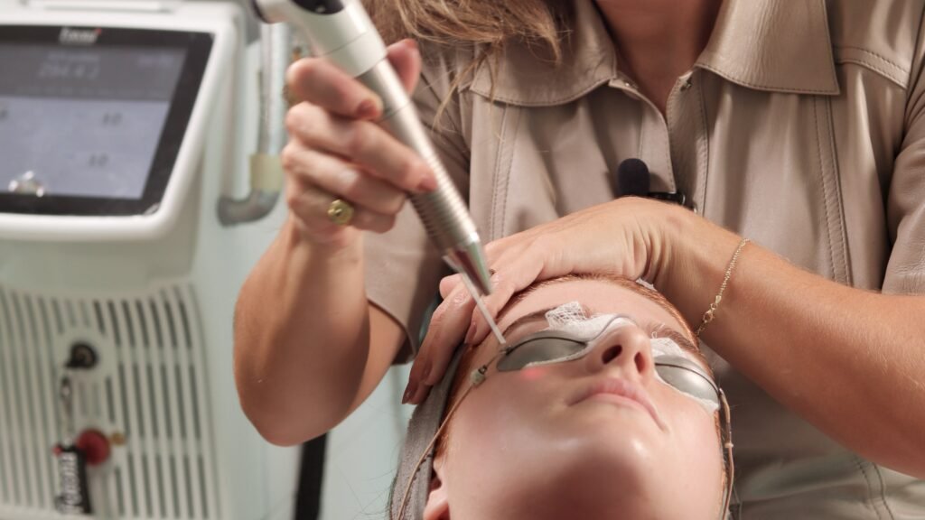 laser para rejuvenescimento
