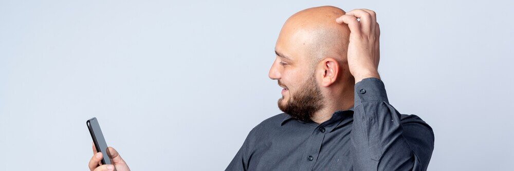 Homem com calv&iacute;cie masculina sorrindo para o celular