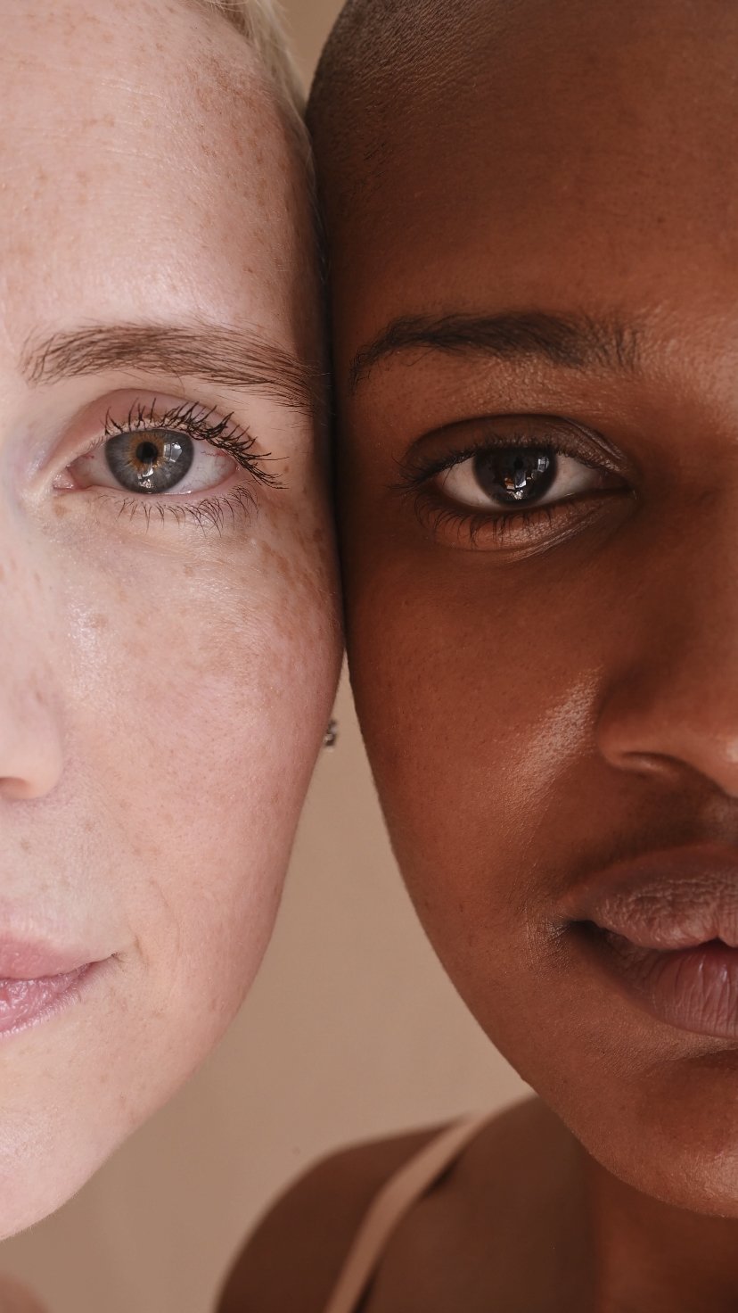 tratamentos para manchas na pele