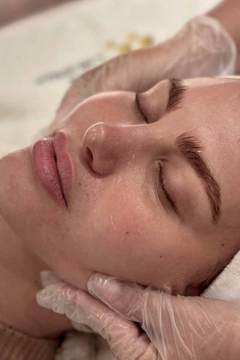 Medicina Regenerativa tratamentos para manchas na pele