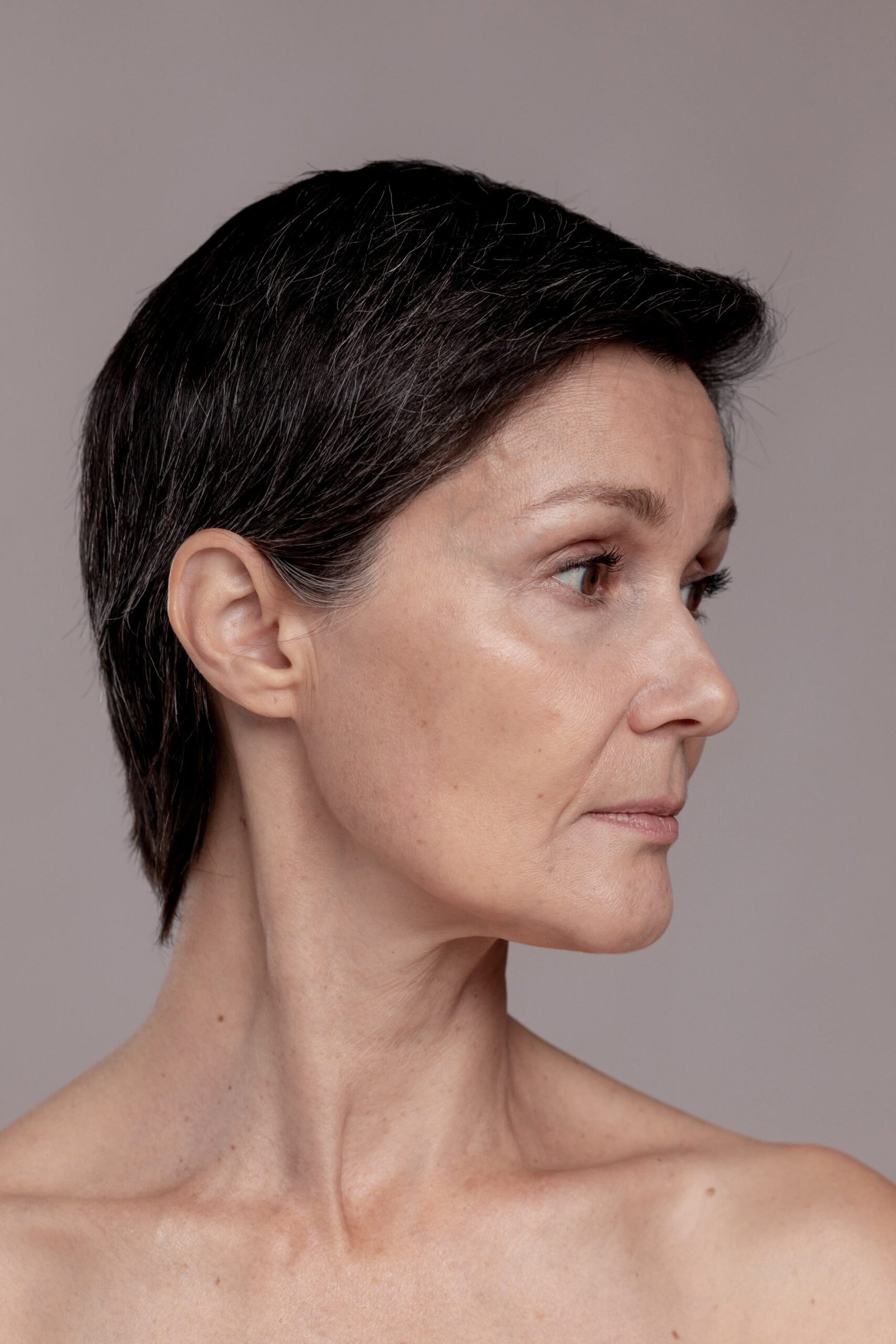 papada sem cirurgia melasma