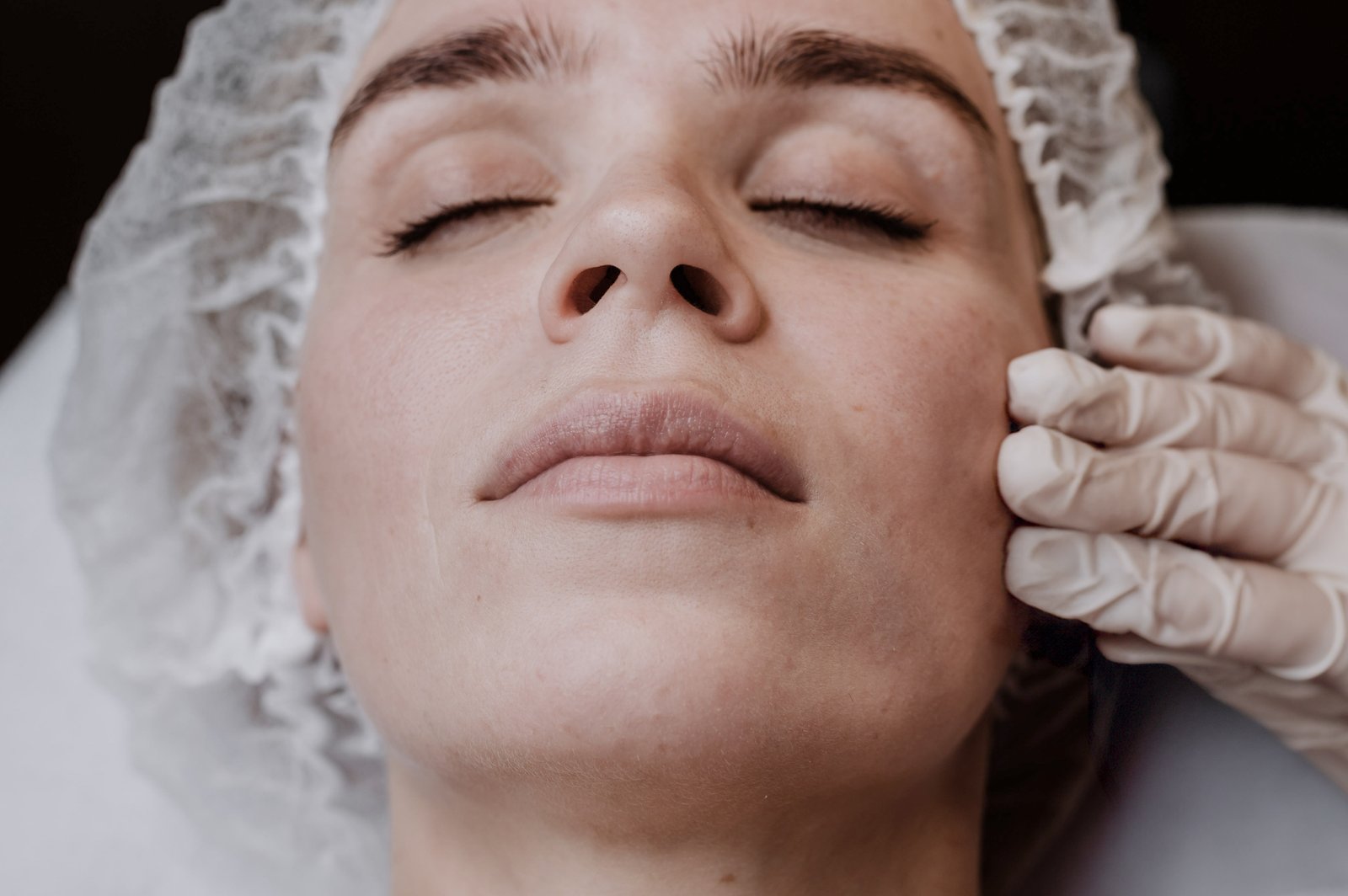 Exossomos aut&oacute;logos prp facial
