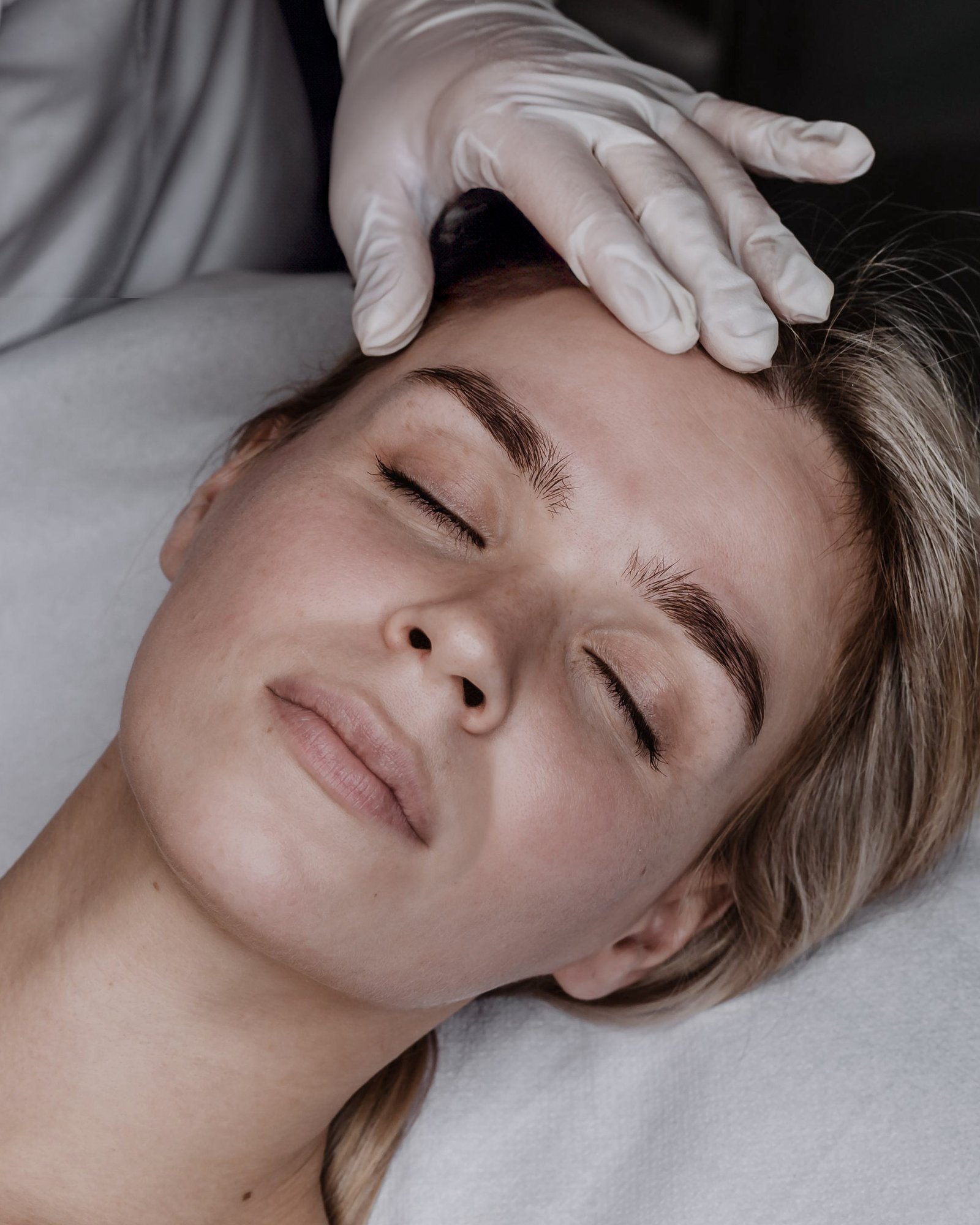 Exossomos aut&oacute;logos