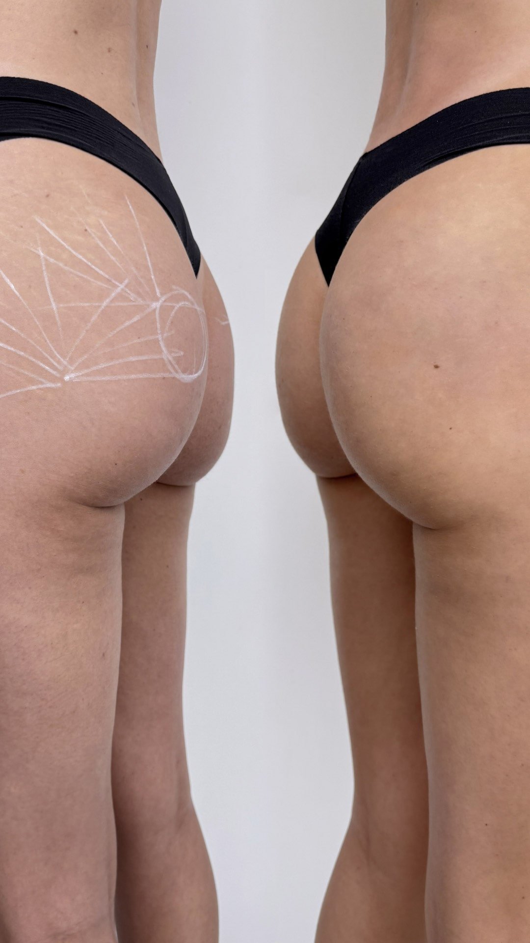 empinar os gl&uacute;teos